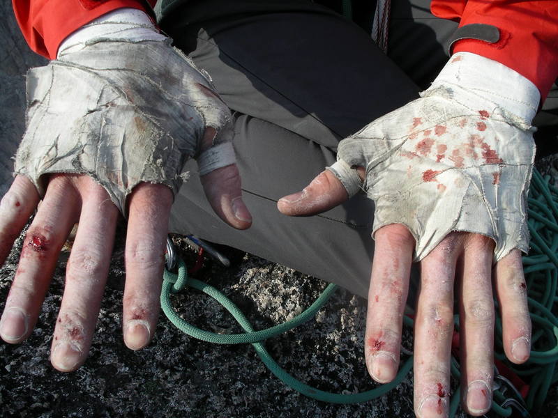 My well worn hands after Sunshine Crack.