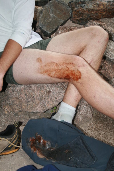 mikes leg at the end of the day. the infamous north chimney incident. mike thought it would be cool to reenact what charlie fowler did. looks like blood. Ha! just a smooshed GU packet. mmm ,it does go well with the chicken. right again peter.