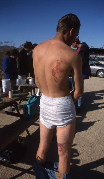 Ben L. after taking a particularly bad fall off of Jane's.