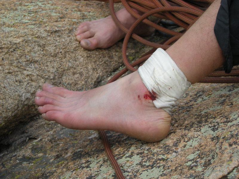 amateur tape job