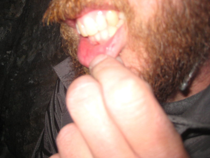 Nate showing me how he scraped the INSIDE of his lip climbing the gnarly chimney with his pack on...ouch. No pics but I hit my front tooth with a caribeaner....not sure how all that happened???