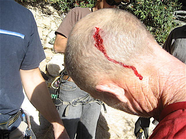 John,if you landed on your head as many times as I have you would look like a dwarf too. I am not a good role model as I never wear a helmet. After smacking my head hard once I decided to wear one for this route. http://www.youtube.com/watch?v=cP_rmd7JicI