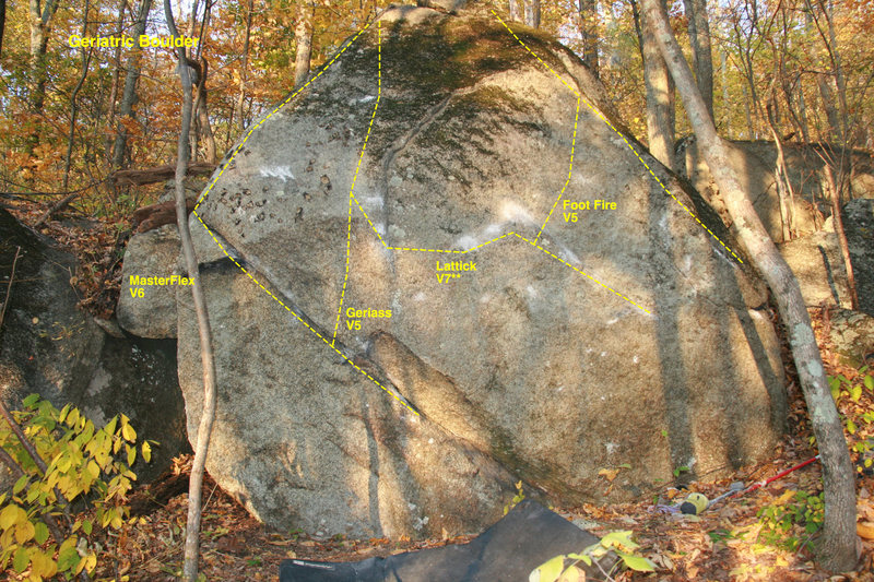 Middle is geriasstrick