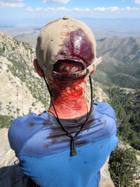 The results of getting brained by rockfall while setting up the route.