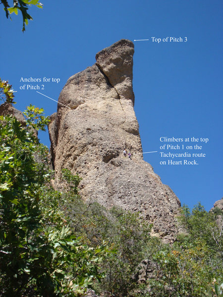 Tachycardia route.