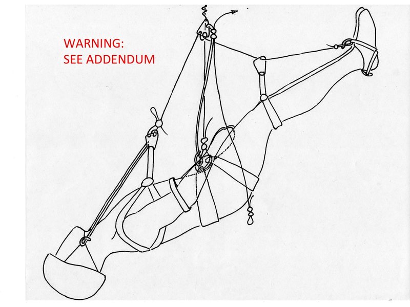 Implications of suspension trauma for climbing self-rescue