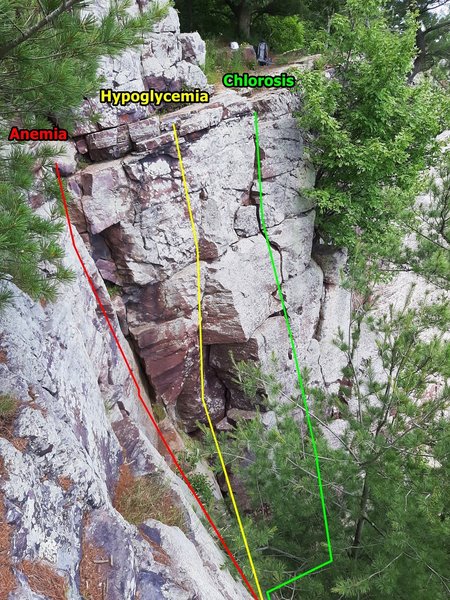 Chlorosis and Hypoglycemia tops.