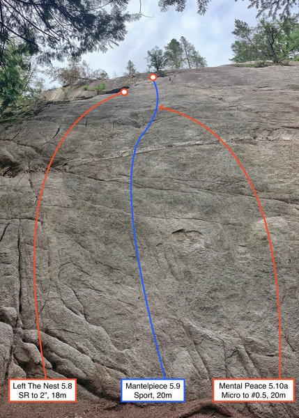 Left side topo