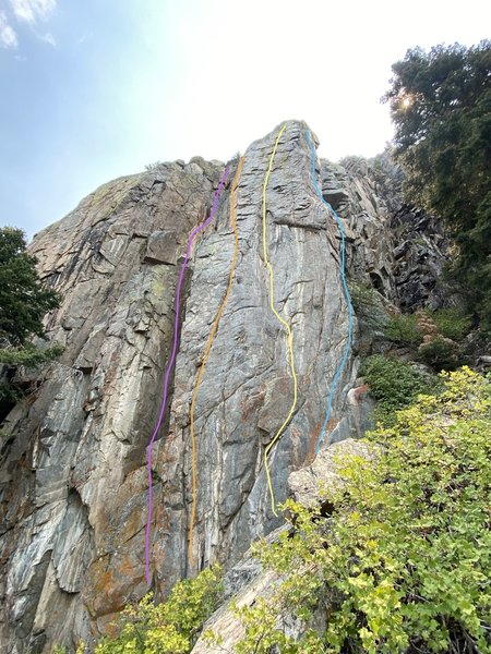 Pink - "Scoliosis".
<br>
Orange - "Thoracic Sands".
<br>
Yellow - "Whiplash".
<br>
Blue - "Spinal Arete".
